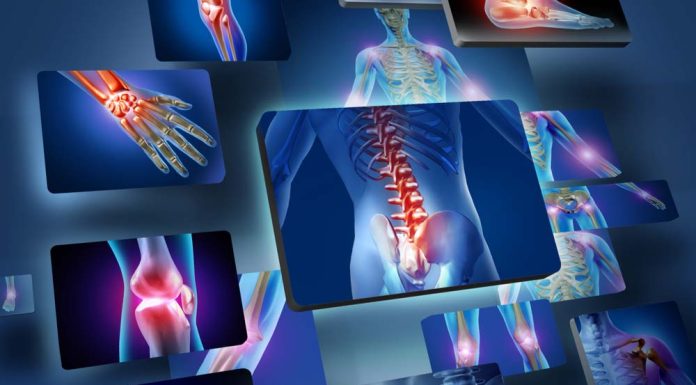 Ameliyatsız Ağrı Tedavisi